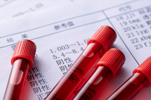 早期唐筛临界风险要不要紧