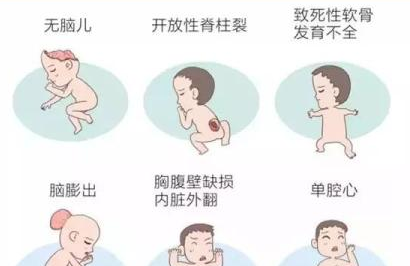 成都玛丽亚天府医院产检怎么样？早孕检查贵吗？