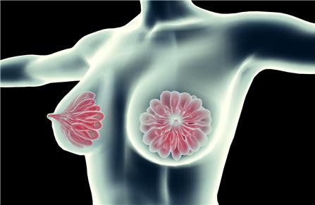 乳腺结节症状是什么