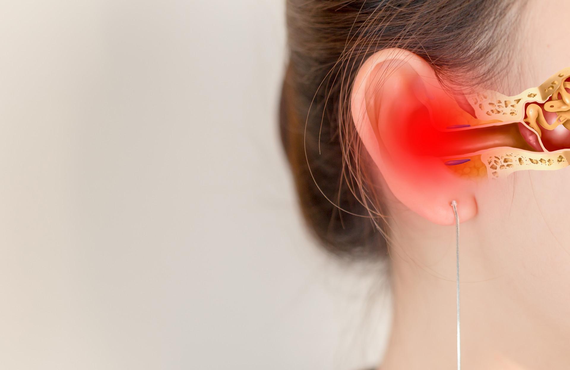 中耳炎分为哪几种类型