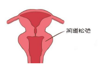 缩阴产品哪个最好?真的会有效果吗