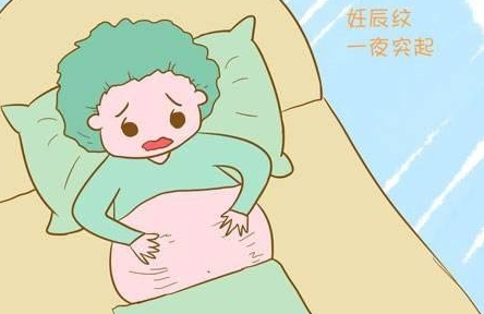 肚子上有妊娠纹怎么办 选对产品方法很简单