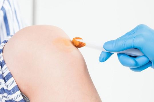 双氧水和碘伏哪个消毒效果好 双氧水和碘伏的区别