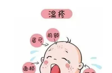 湿疹怎么引起的？宝宝湿疹止痒妙招，宝妈看过来！