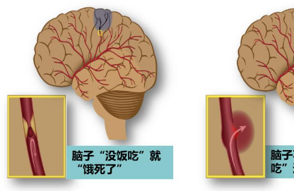 脑栓通胶囊功效与作用 脑栓通胶囊说明书了解清楚再吃！