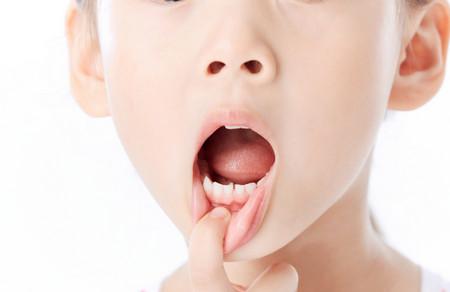 小孩换牙期间需要注意些什么