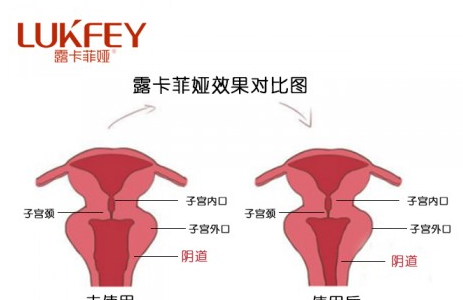 揭秘！缩阴术有用吗,会不会后遗症