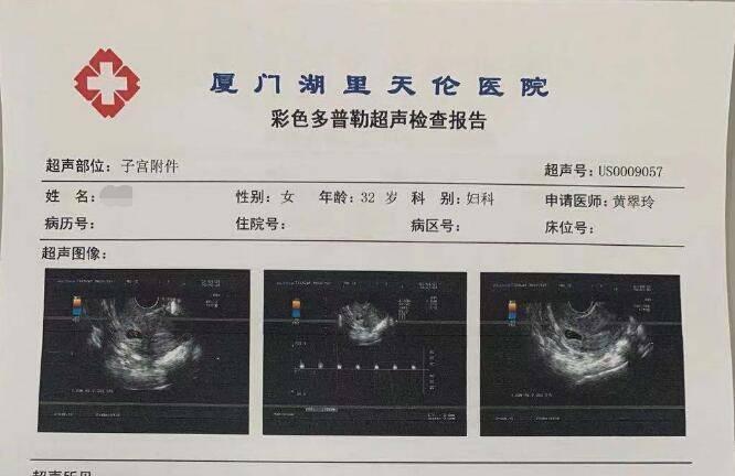 厦门天伦医院黎艳主任宫颈粘连分离手术案例分享