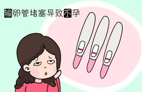 女性输卵管异常通常分为这几类，是否影响怀孕?