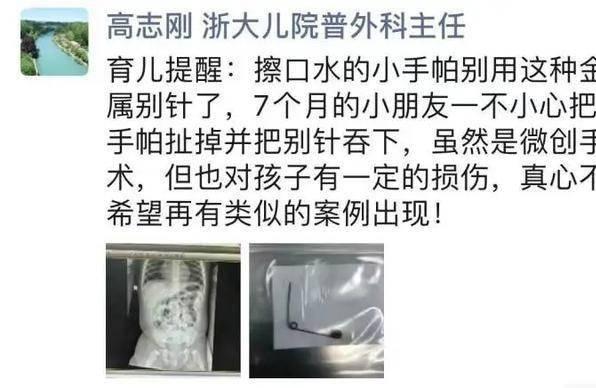 7个月女婴肠子被戳破！儿科专家提醒：小手帕上别用金属别针了