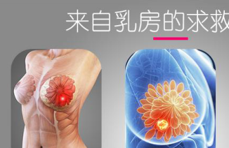 乳腺小叶增生严重吗 乳腺小叶增生怎样治疗效果才好