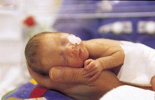 打破了世界纪录，最小婴儿只有拇指大小，15年后她现状如何了？